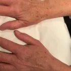 La imagen 2 de la Empresa CENTRO DERMATOLÓGICO DR. JAVIER BASSAS BRESCA Salud y Medicina en Barcelona B