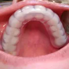 La imagen 2 de la Empresa CENTRO EUROPEO MÉDICO DENTAL Salud y Medicina en Alcobendas M