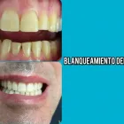 La imagen 16 de la Empresa CENTRO EUROPEO MÉDICO DENTAL Salud y Medicina en Alcobendas M