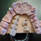 La imagen 17 de la Empresa CENTRO EUROPEO MÉDICO DENTAL Salud y Medicina en Alcobendas M