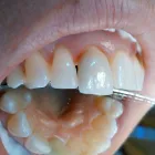 La imagen 18 de la Empresa CENTRO EUROPEO MÉDICO DENTAL Salud y Medicina en Alcobendas M