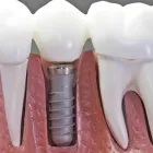 La imagen 23 de la Empresa CENTRO EUROPEO MÉDICO DENTAL Salud y Medicina en Alcobendas M
