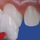La imagen 24 de la Empresa CENTRO EUROPEO MÉDICO DENTAL Salud y Medicina en Alcobendas M