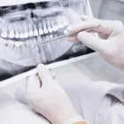 La imagen 6 de la Empresa CLÍNICA DENTAL LÓPEZ GONZÁLEZ Dentistas en Madrid M