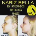La imagen 7 de la Empresa CORRECTORES NASALES Salones de Belleza en Madrid M