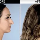 La imagen 20 de la Empresa CORRECTORES NASALES Salones de Belleza en Madrid M