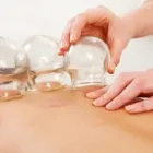 La imagen 3 de la Empresa PM-ACUPUNTURA Salud y Medicina en Palma de Mallorca IB
