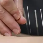 La imagen 7 de la Empresa PM-ACUPUNTURA Salud y Medicina en Palma de Mallorca IB