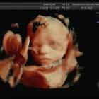 La imagen 7 de la Empresa SAMARANCH CONSULTA Medicos Especialistas: Ginecologia Y Obstetricia en Barcelona B
