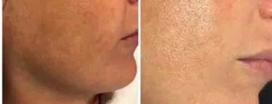 La imagen 3 de la Empresa SALÓN DE BELLEZA LOTUS Productos y Servicios de Cuidado Personal en Barcelona B