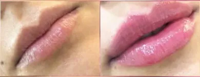 La imagen 32 de la Empresa SALÓN DE BELLEZA LOTUS Productos y Servicios de Cuidado Personal en Barcelona B
