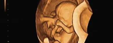 La imagen 6 de la Empresa SAMARANCH CONSULTA Medicos Especialistas: Ginecologia Y Obstetricia en Barcelona B