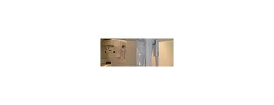 La imagen 6 de la Empresa SOLMAN 1010, S.L. Odontologos Y Estomatologos: Periodoncia en Madrid M
